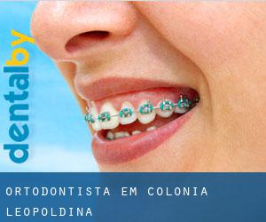 Ortodontista em Colônia Leopoldina
