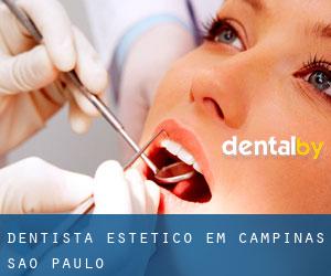 Dentista estético em Campinas (São Paulo)