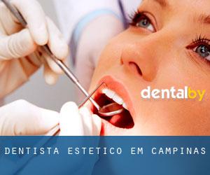 Dentista estético em Campinas