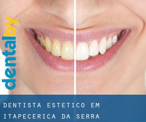 Dentista estético em Itapecerica da Serra