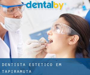 Dentista estético em Tapiramutá