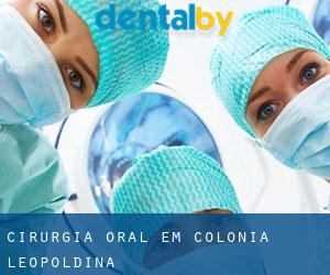 Cirurgia oral em Colônia Leopoldina