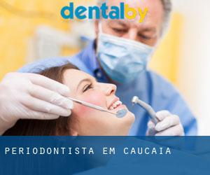 Periodontista em Caucaia Periodontista em Caucaia