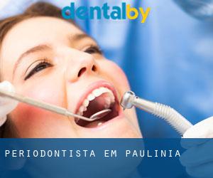 Periodontista em Paulínia Periodontista em Paulínia
