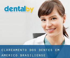Clareamento dos dentes em Américo Brasiliense