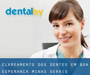 Clareamento dos dentes em Boa Esperança (Minas Gerais)