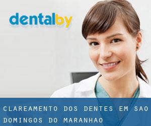 Clareamento dos dentes em São Domingos do Maranhão