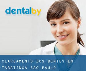 Clareamento dos dentes em Tabatinga (São Paulo)
