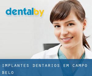 Implantes dentários em Campo Belo