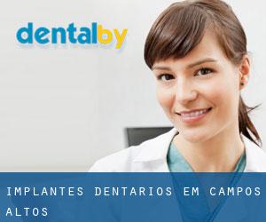 Implantes dentários em Campos Altos