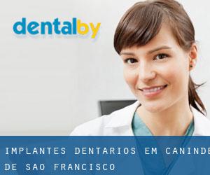 Implantes dentários em Canindé de São Francisco