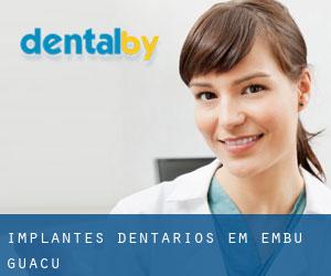 Implantes dentários em Embu-Guaçu