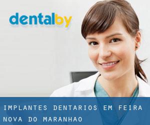 Implantes dentários em Feira Nova do Maranhão
