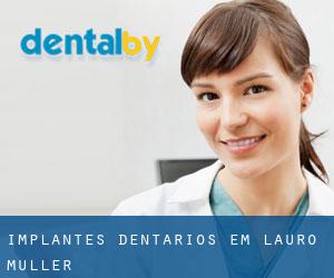 Implantes dentários em Lauro Muller