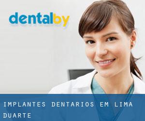 Implantes dentários em Lima Duarte
