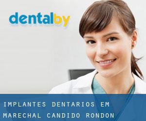 Implantes dentários em Marechal Cândido Rondon