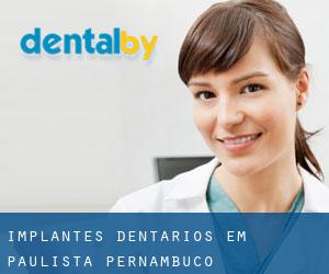 Implantes dentários em Paulista (Pernambuco)