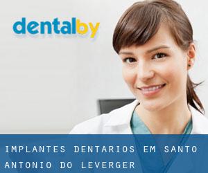 Implantes dentários em Santo Antônio do Leverger