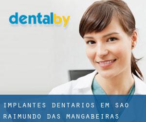 Implantes dentários em São Raimundo das Mangabeiras