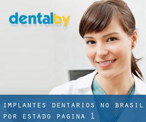 Implantes dentários no Brasil por Estado - página 1